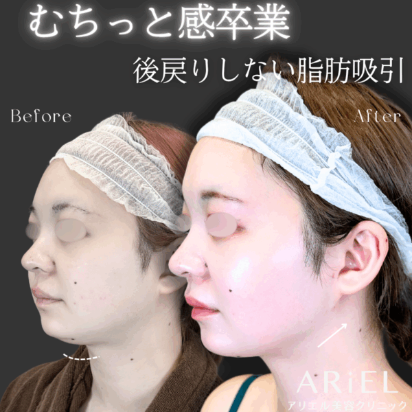 No.9143の症例写真